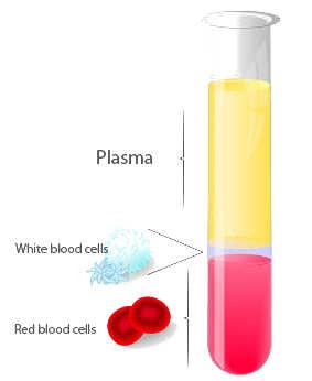 PRP Hair Treatment Dubai